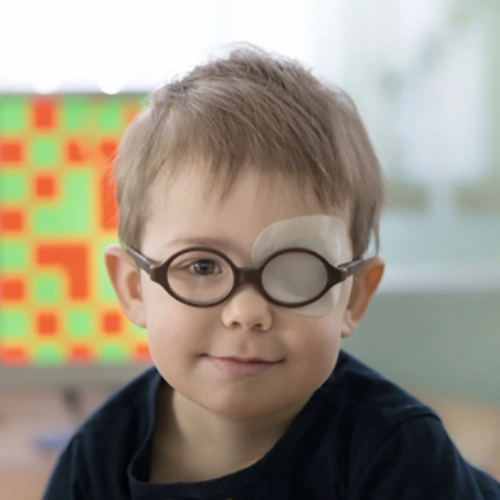 Enfant ayant une amblyopie Enfant portant un cache oculaire pour traiter une amblyopie