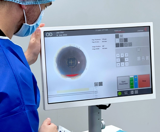 Chirurgie LASIK à Lyon pour corriger la vision au laser