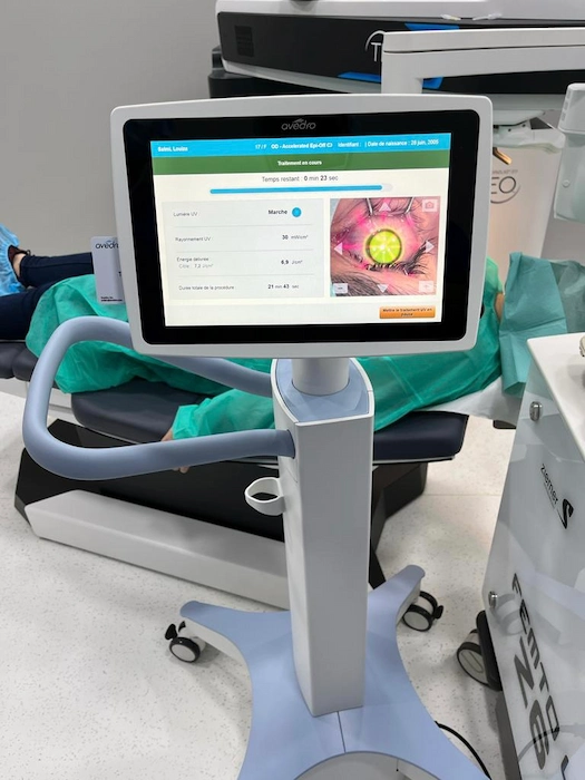 Machine laser pour opération des yeux à Lyon – chirurgie réfractive Clinique de la Vue