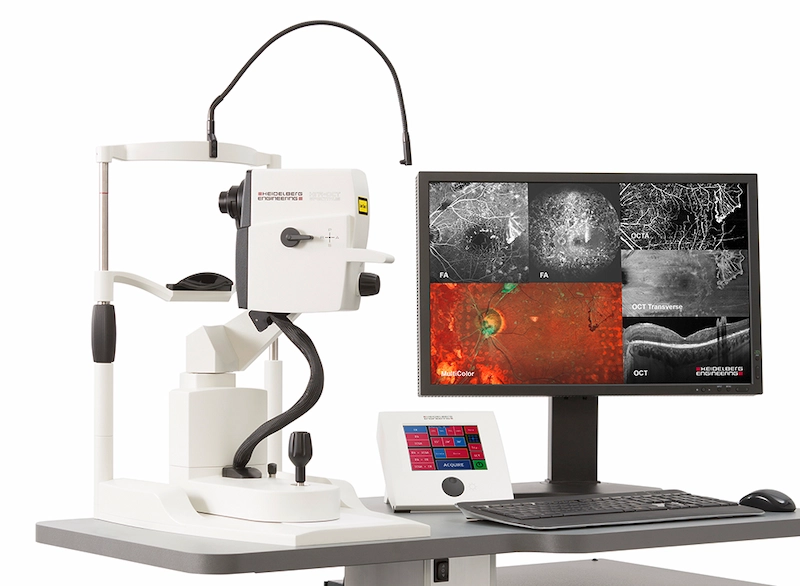 OCT Heidelberg Spectralis III utilisé pour l’analyse de la rétine et du nerf optique à Lyon