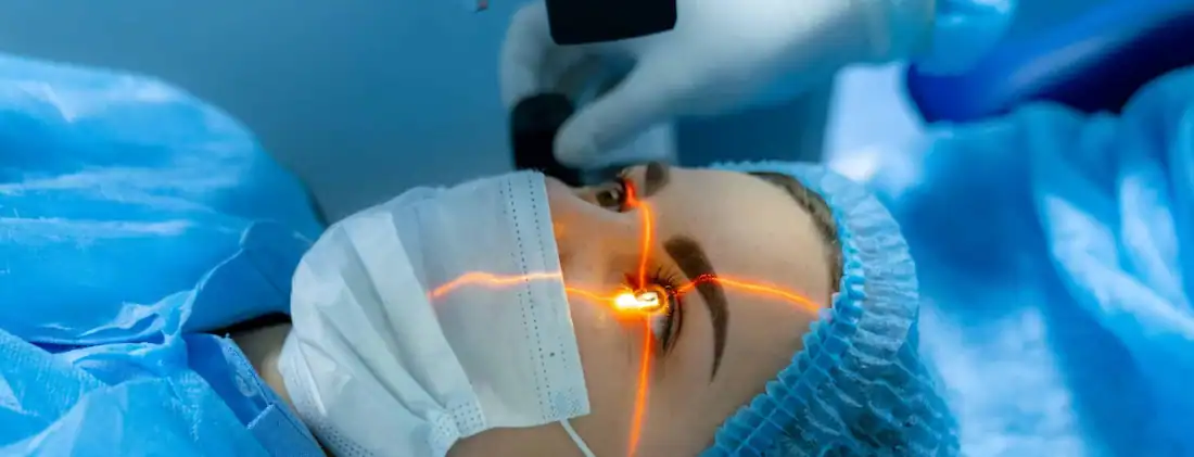 clinique-de-la-vue-operation-laser-yeux-lyon-ecully-tassin-dardilly Techniques de chirurgie oculaire