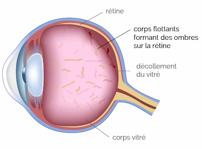 Schéma des corps flottants