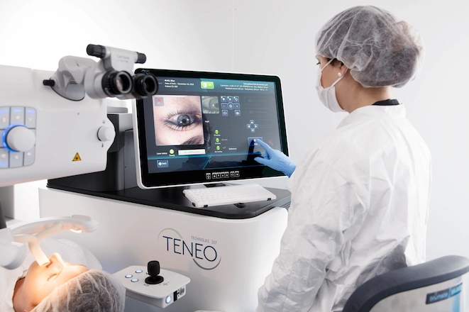 Laser TENEO de Bausch + Lomb utilisé pour la chirurgie réfractive à la Clinique de la vue Lyon
