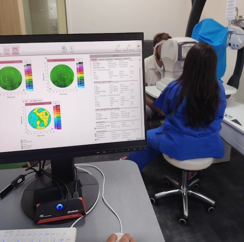 Topographie cornéenne ANTERION – bilan préopératoire chirurgie réfractive, Clinique de la vue Lyon 9