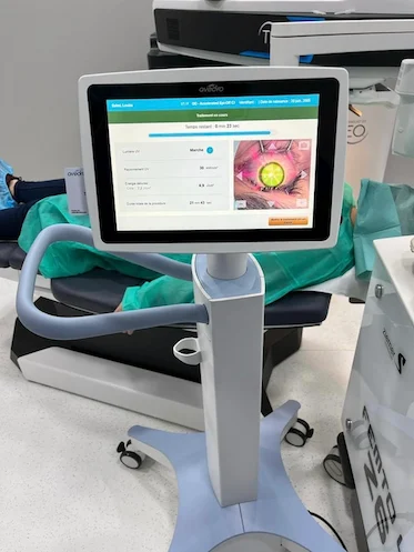 Machine laser pour opération des yeux à Lyon – chirurgie réfractive Clinique de la Vue